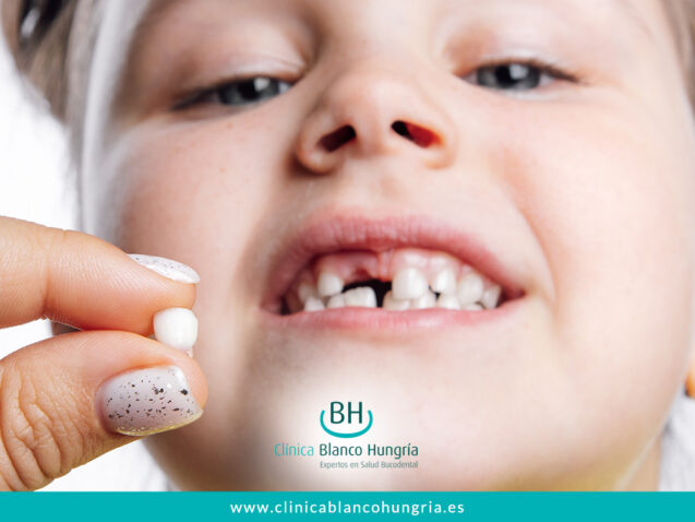 Cómo Actuar ante un Traumatismo Dental