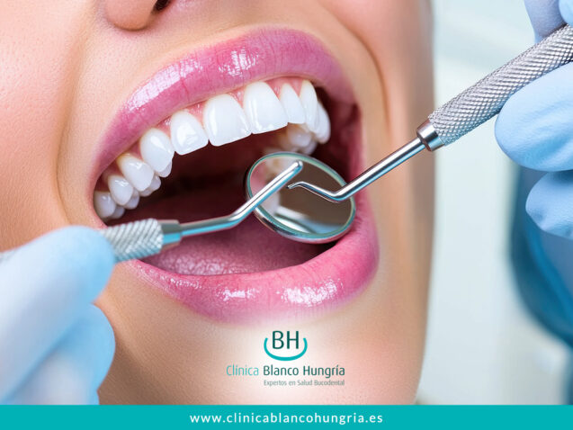 ¿Cuándo es el Momento Ideal para una Limpieza Dental?