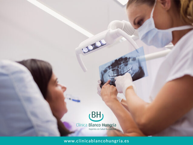 Guía rápida: ¿Qué hacer si se rompe tu prótesis dental?