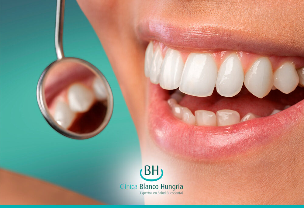 Redefine tu Sonrisa con Naturalidad y Confianza