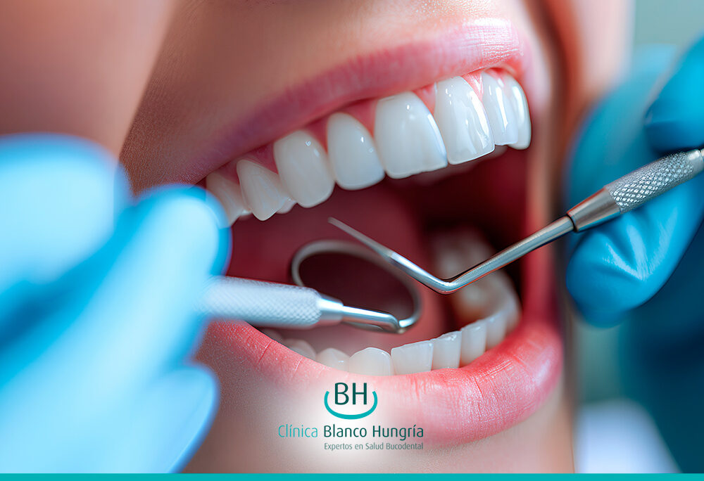 Revisiones Dentales: Clave para una Sonrisa Saludable